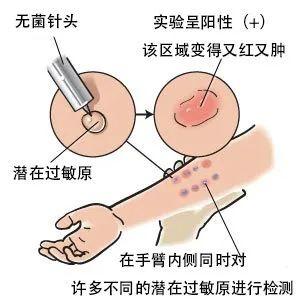 螨虫