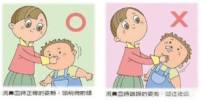 美国儿童急救常识