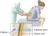 妈妈分享 – 催产无痛分娩(Epidural)顺产产经 在美国生孩子