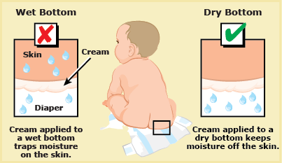 宝宝尿布疹预防护理方法