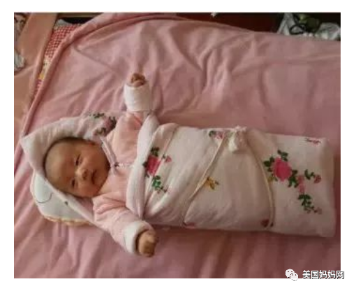 宝宝髋关节发育不良 宝宝髋关节发育不良