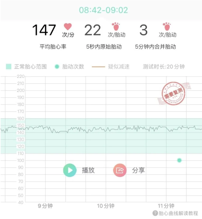 美国妈妈胎心监测 美国妈妈胎心监测