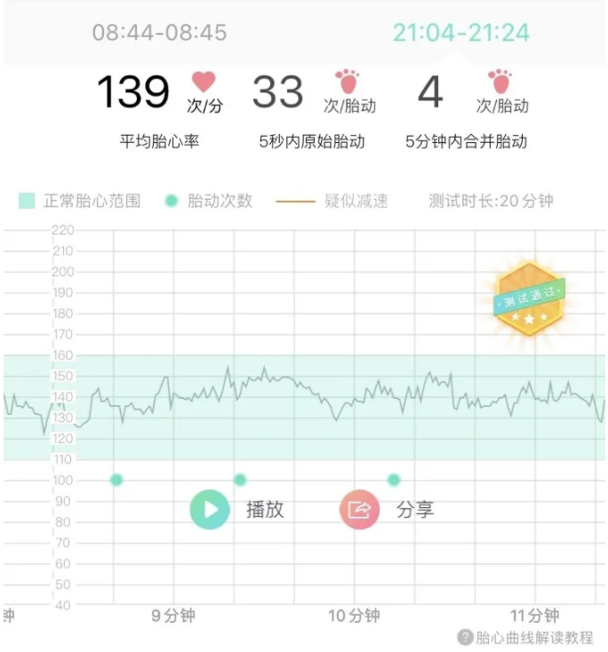 美国妈妈胎心监测 美国妈妈胎心监测