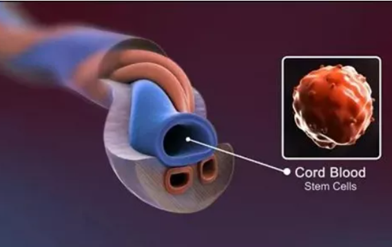 美国宝宝脐带血储存