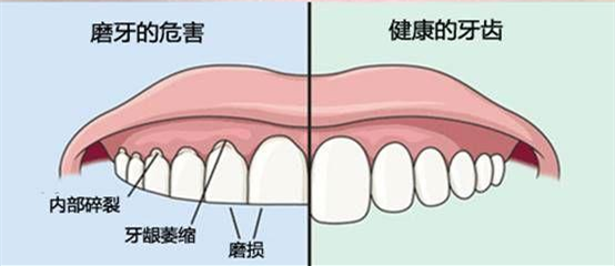 咯吱咯吱……什么声音？有老鼠？不，是宝宝在磨牙！怎么办？