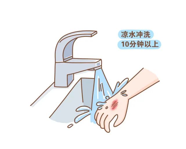 孩子烧烫伤,冷静!最佳处理时间只有2分钟 孩子烧烫伤怎么办?什么时候去看医生?
