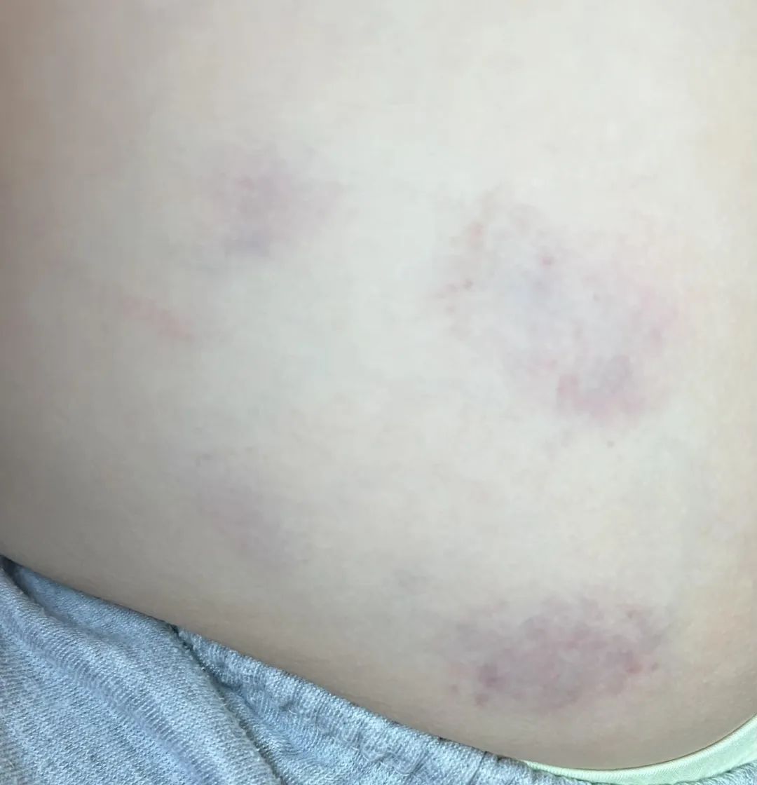 【妈妈分享】孩子在美国daycare被老师abuse,我是这样做的 【妈妈分享】孩子在美国daycare被老师abuse,我是这样做的