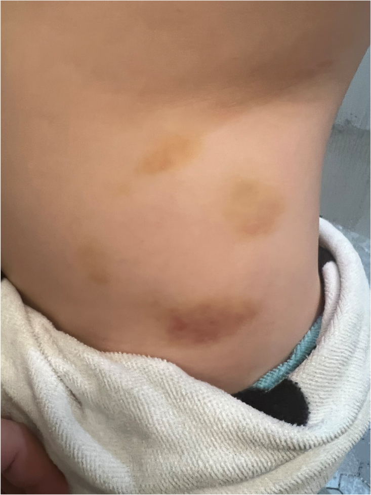 【妈妈分享】孩子在美国daycare被老师abuse,我是这样做的 【妈妈分享】孩子在美国daycare被老师abuse,我是这样做的