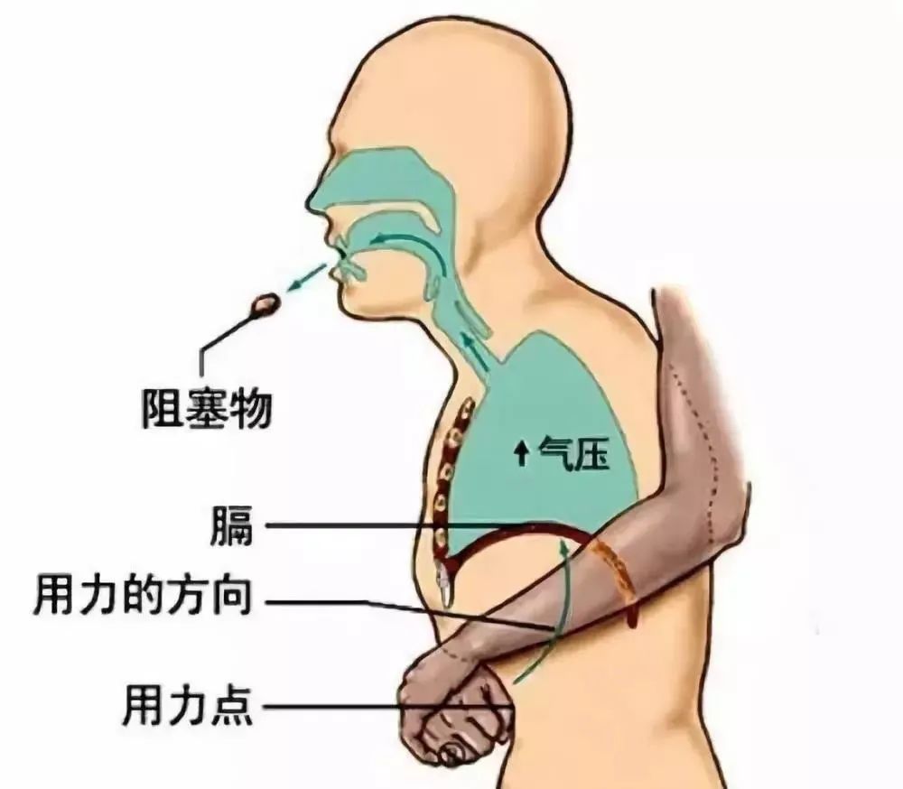 危急时她靠这个救了学生一命,快来学学吧! 危急时她靠这个救了学生一命,快来学学吧!