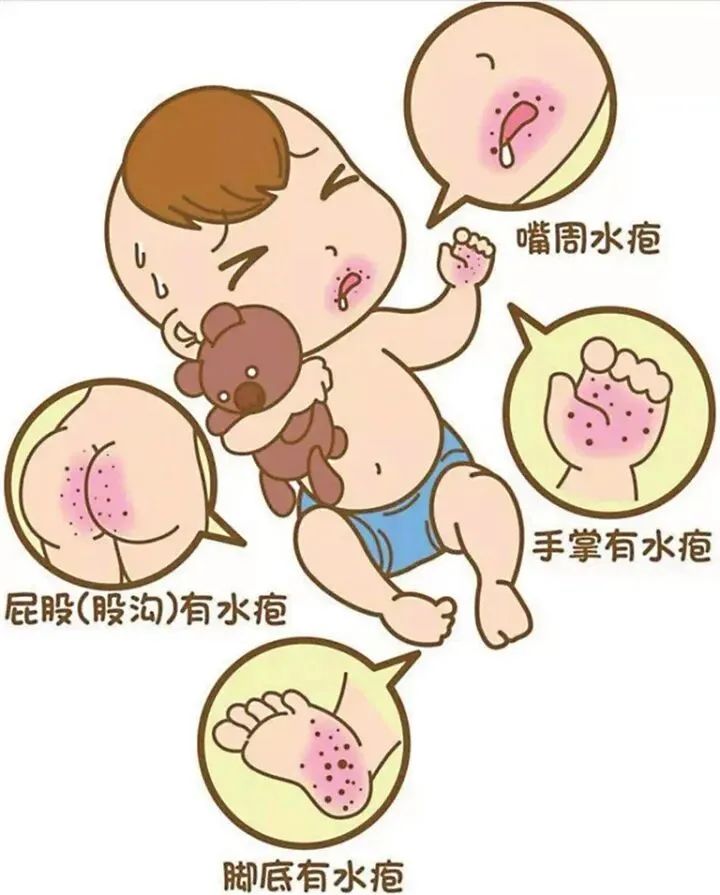 警惕!手足口病的入侵可能就是一个不留意,如何远离它呢? 警惕!手足口病的入侵可能就是一个不留意,如何远离它呢?