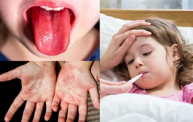 简单的喉咙痛会致命吗？科州已有2名儿童死于此细菌的入侵，“三流行”竟然是它的帮凶！