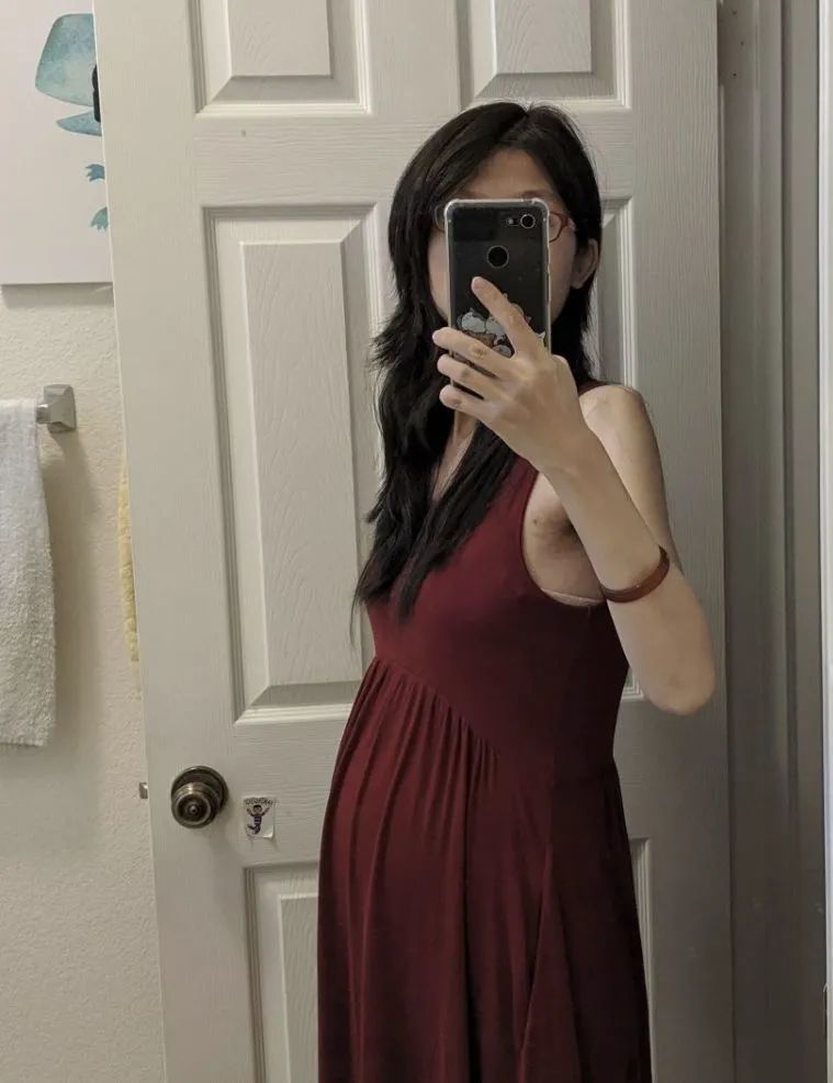 【妈妈分享】高龄妊娠ICU历险记 【妈妈分享】高龄妊娠ICU历险记