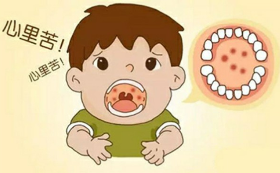 神似手足口病，专爱针对幼儿，疱疹性咽峡炎应该如何应对？