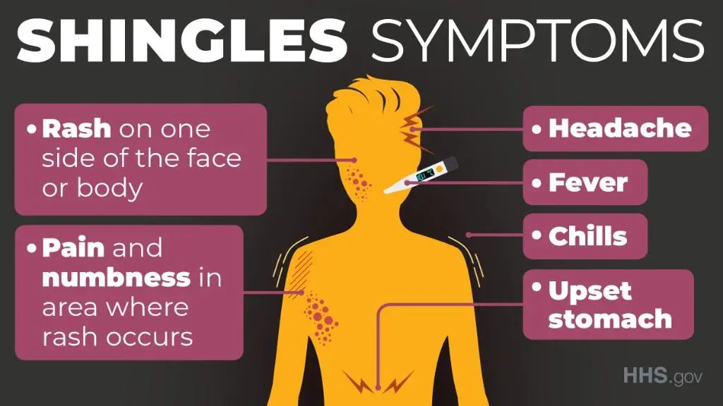发烧、咳嗽、头疼、想吐，你以为得了COVID、Flu、RSV？NO！这是带状疱疹在作怪！