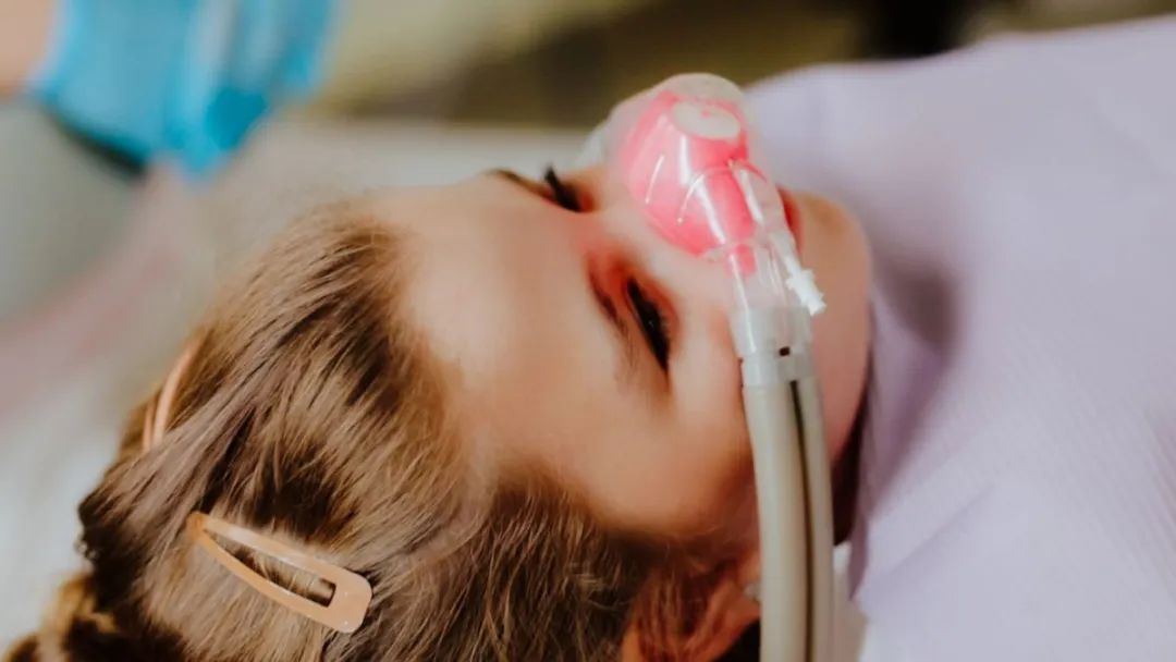 孩子治疗牙齿时会用到的笑气（laughing gas）是什么？对孩子有什么副作用?